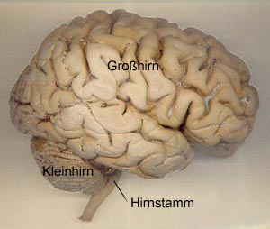 Foto: Menschliches Gehirn