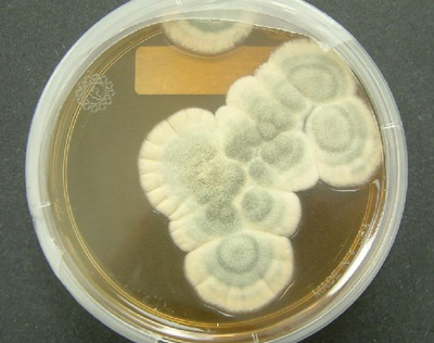 Foto: Petrischale mit einer Schimmelpilzkultur