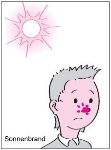 Zeichnung: Junge mit Sonnenbrand auf der Nase