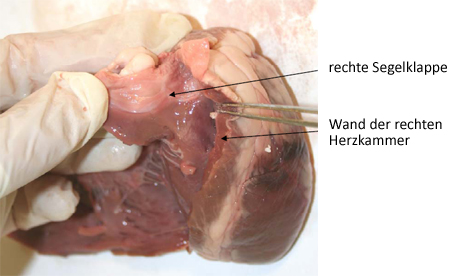 Foto: Segelklappe in der rechten
Herzhälfte