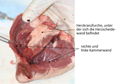 Foto: Offene rechte und linke
Herzkammern