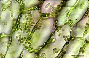 Blattzellen der Wasserpest unterm Lichtmikroskop